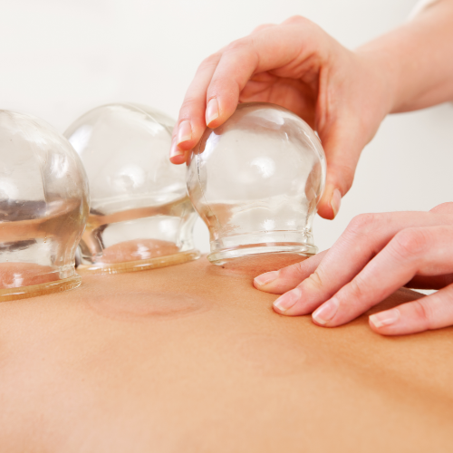 Cupping - Amplify Physical Therapy and Wellness in Bolingbrook, IL