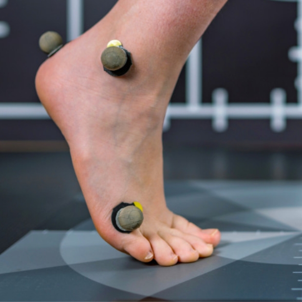 Gait Analysis - Amplify Physical Therapy and Wellness in Bolingbrook, IL