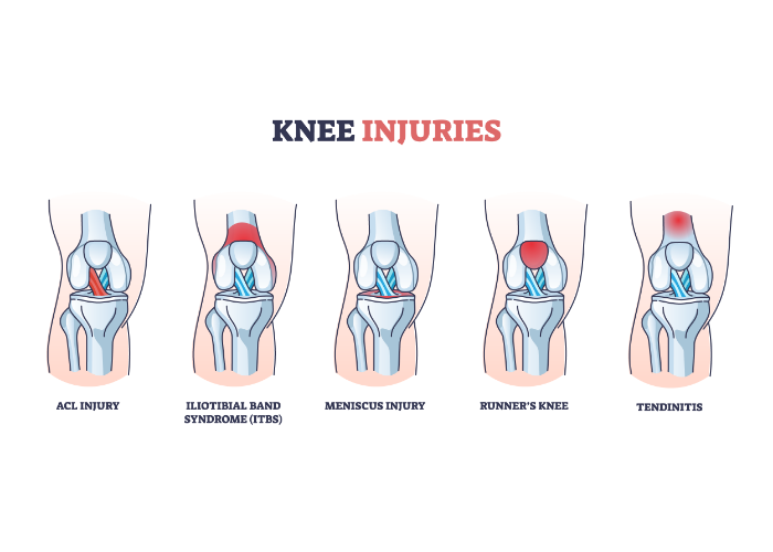 knee-pain-relief-amplify-physical-therapy-and-wellness-bolingbrook-il