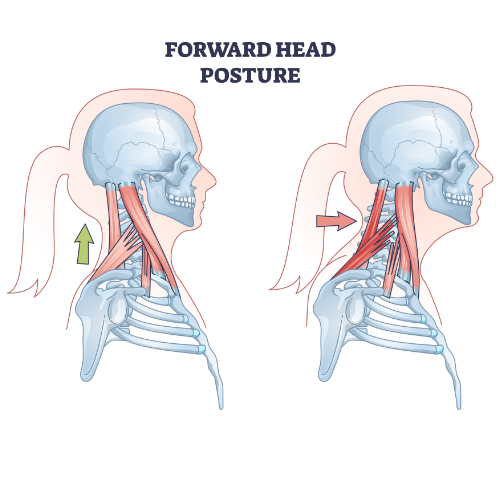 neck-pain-relief-Amplify-Physical-Therapy-and-Wellness-Bolingbrook-IL