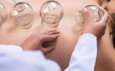 Find Neck Pain Relief with Cupping: A Physical Therapist’s Approach