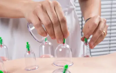 Relieving Muscle Pain with Cupping