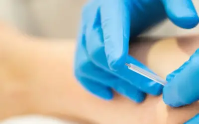 Myths and Facts About Dry Needling