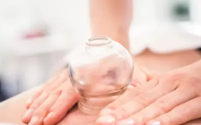 Effective Cupping Therapy Techniques