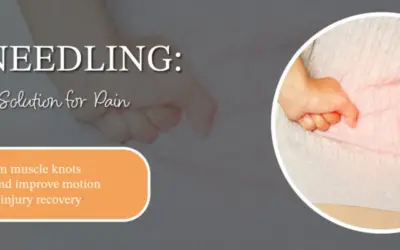 Dry Needling: The Effective Solution for Pain Management